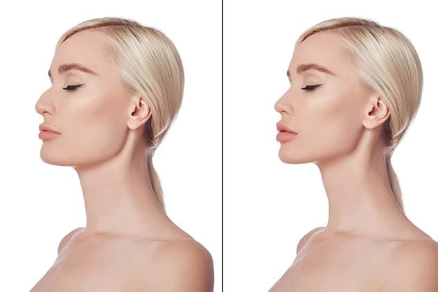 Valley Clinic procedure 5